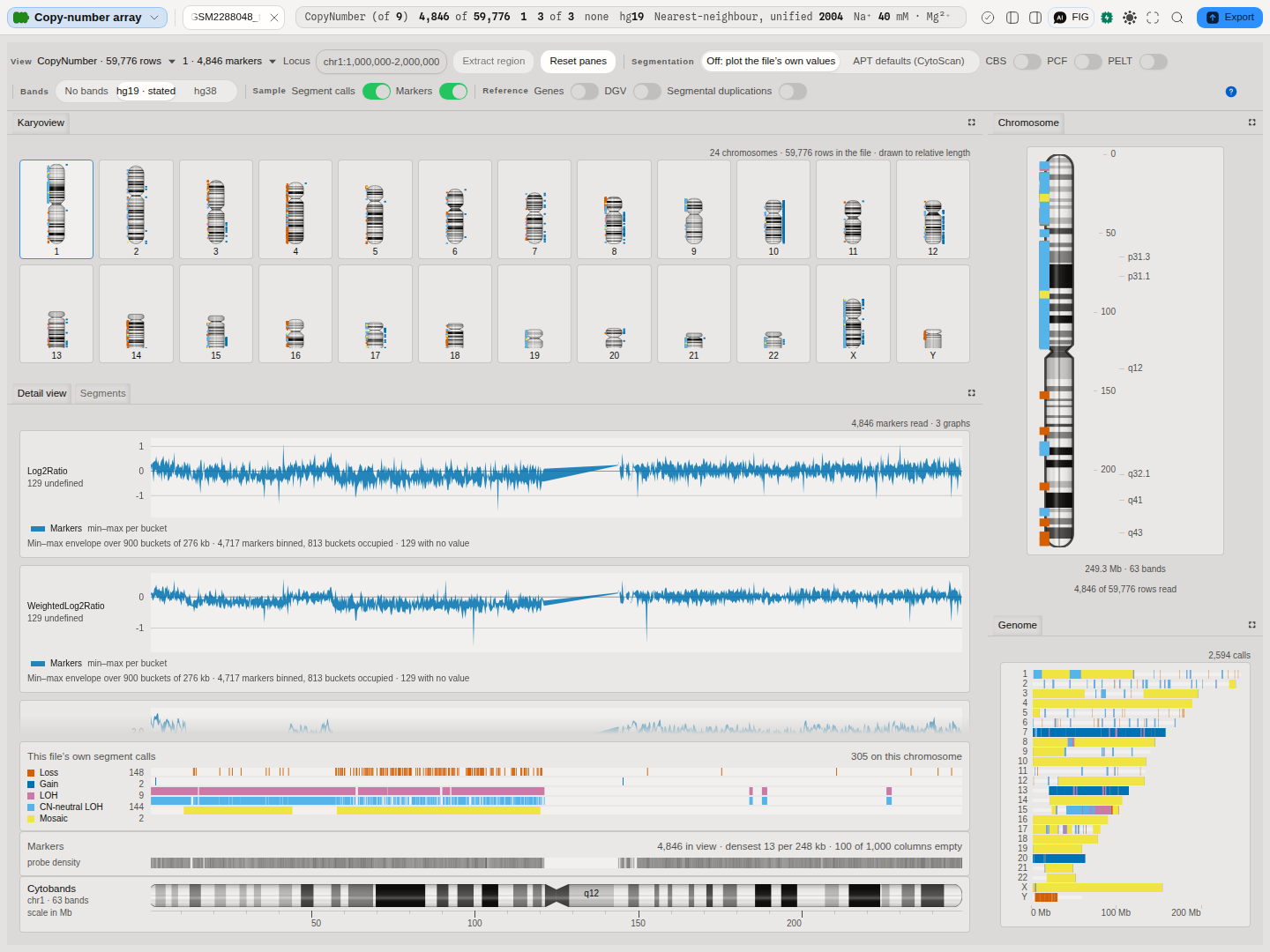 A tumour-biopsy CytoScan result with its genome scanned. The karyoview shows all twenty-four chromosomes at their true relative lengths with each one's calls marked beside it; the detail view stacks two of the file's graphs over one shared base-pair axis, each with its own fitted scale and the binning stated beneath it; the file's own segment calls run in five lanes below them, one per call type, over the same axis; and the cytoband ruler at the foot names the bands the window covers. The right column holds the selected chromosome as a banded ideogram and the whole genome as a profile, 2,594 calls painted along it.